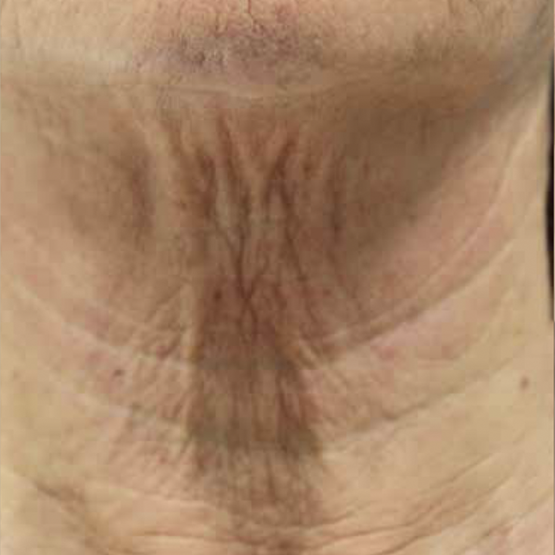 Before image