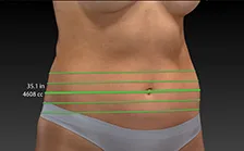 BODY SCULPTOR Canfield