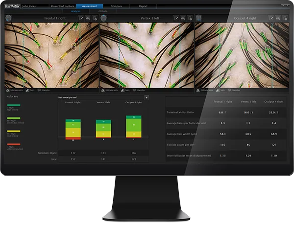 airmetrix-assessment-screen