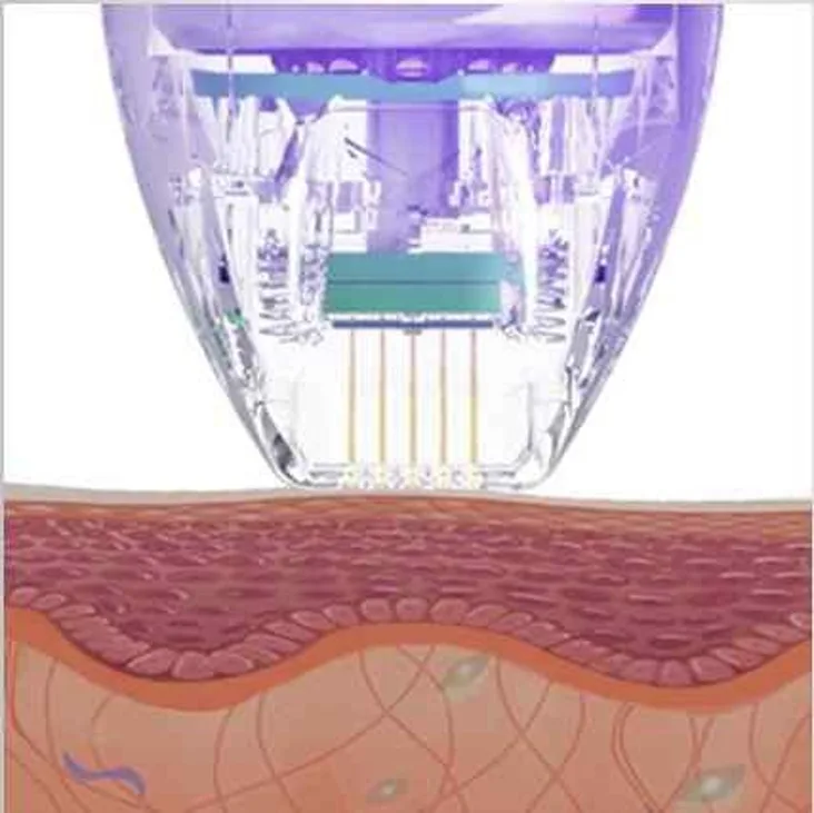 Mecanismo de ação Secret RF