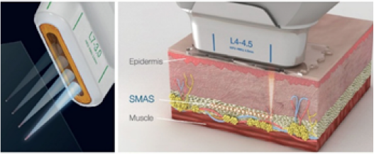 https://www.medsystems.com.br/wp-content/uploads/2022/05/microfocada-1-1.png