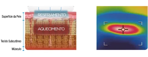 Tecnologia de Resfriamento