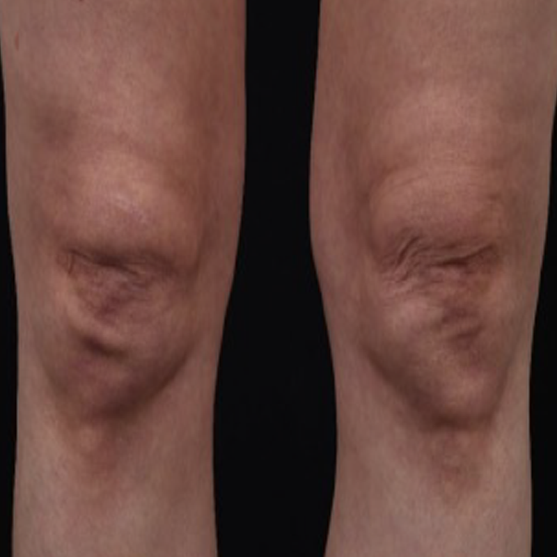 After image