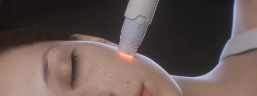 21.10 - Diferenças RF