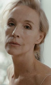 Rugas-tratamento-440x720